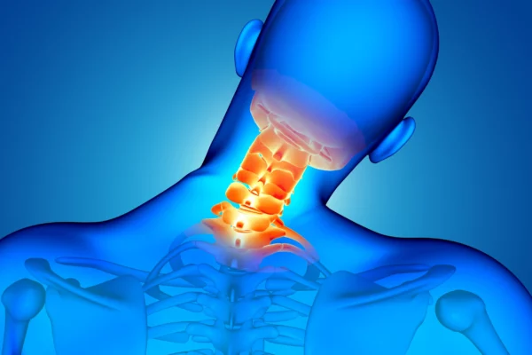 Ayurveda-Management-of-Ankylosing-Spondylitis