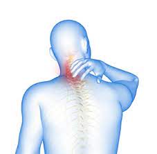cervical spondylosis