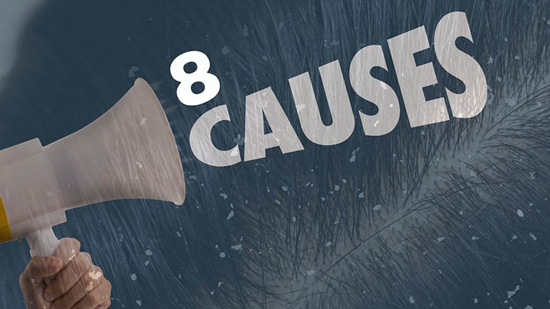 Ayurvedic tips for dandruff and hair fall: Home Remedies vs. Doctor Consultation 2 home remedies for dandruff and hairfall