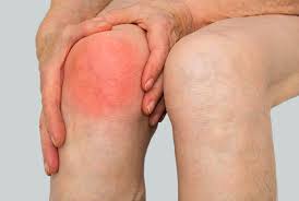 Ayurveda treatment for Arthritis 8 Ayurveda treatment for rheumatoid arthritis, Septic arthritis