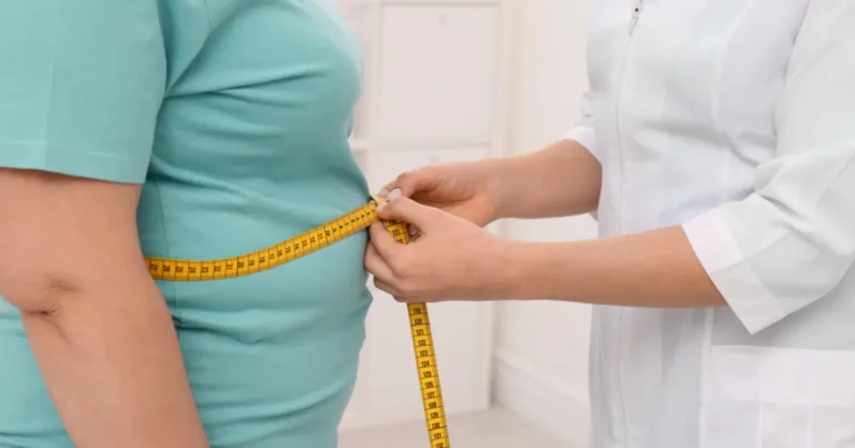 Ayurvedic treatment for Obesity 1 Ayurveda treatment for obesity, complications of obesity