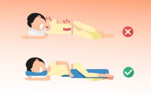 Ayurveda Home Remedies for Sciatica
