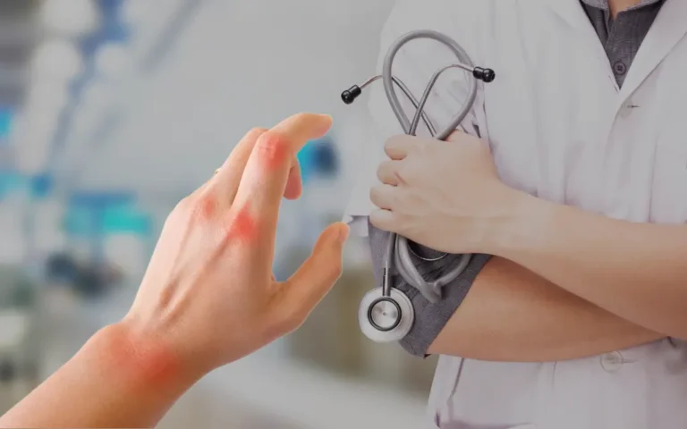Rheumatoid Arthritis Be Inherited
