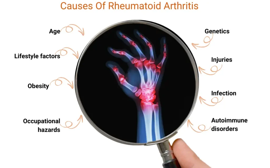 Ayurvedic treatment for Rheumatoid Arthritis 3 Ayurveda treatment for Rheumatoid arthritis