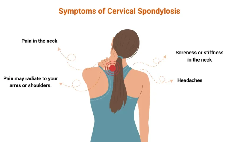 Ayurvedic treatment for Cervical Spondylosis 2 Ayurveda treatment for cervical spondylosis