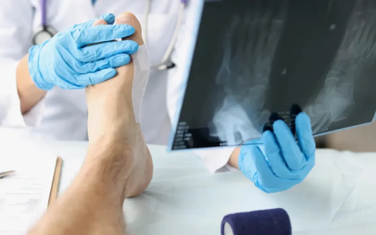 Rheumatoid Arthritis Cure in Ayurveda