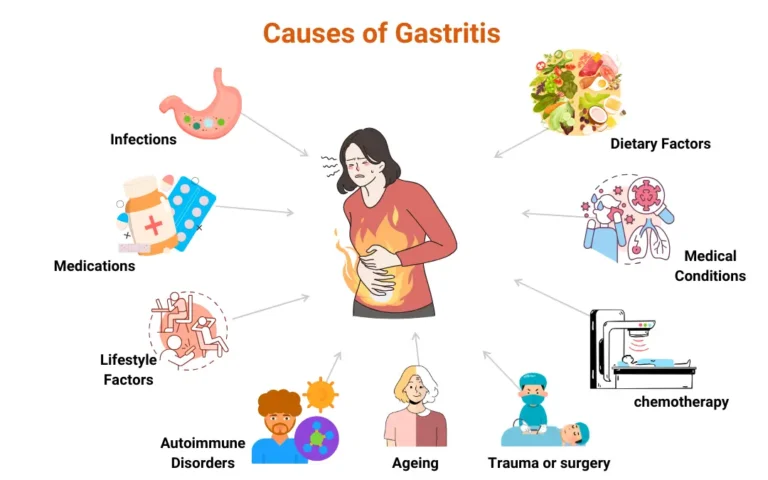 Ayurvedic remedies for gastritis