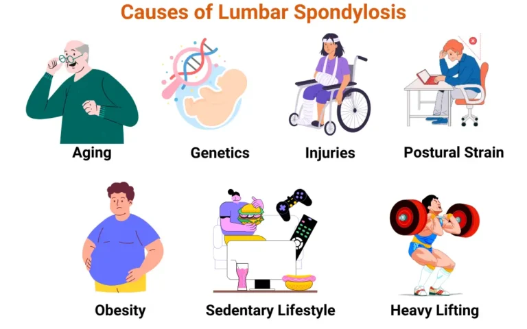 Ayurvedic Treatment for Lumbar Spondylosis