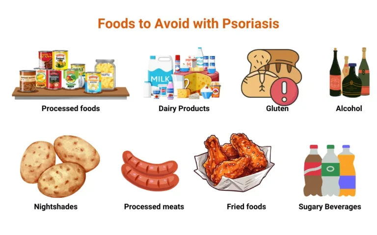 psoriasis treatment