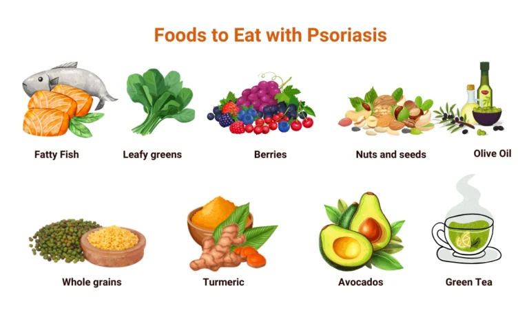 psoriasis treatment