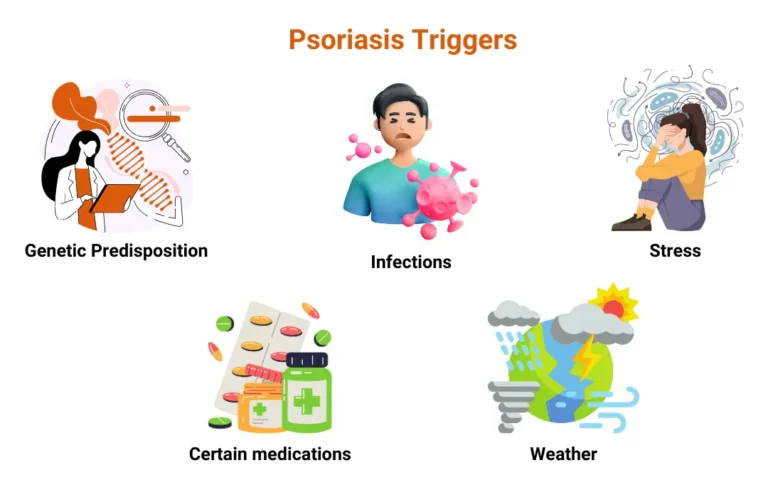 Psoriasis Treatment