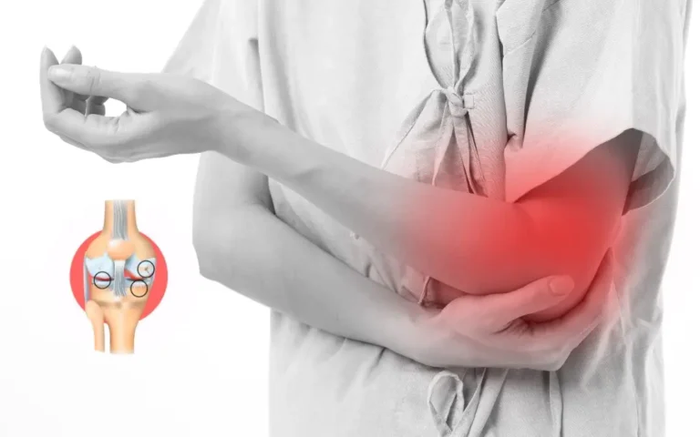 stages of Osteoarthritis