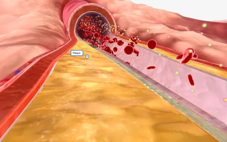 Ever wondered how Ayurveda’s Guduchi can transform your triglyceride levels? Discover the ancient secret to better heart health!
