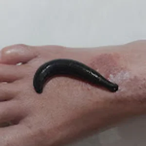 Ayurveda clinic in bangalore